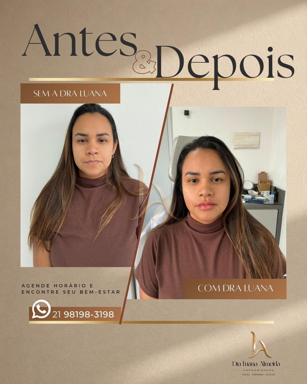 Beleza e autoestima — antes e depois