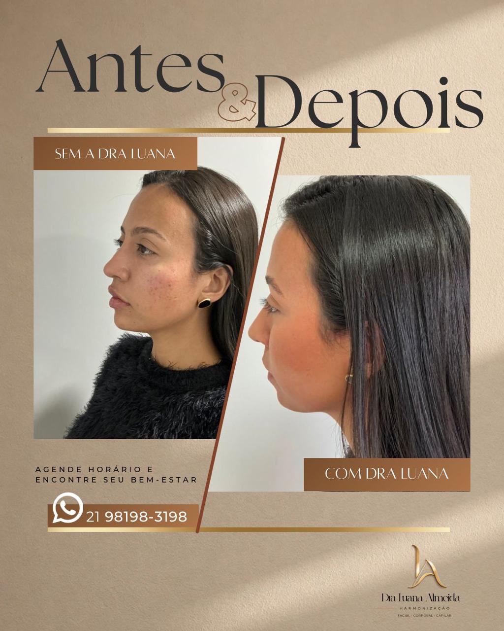 Qualidade da pele — antes e depois
