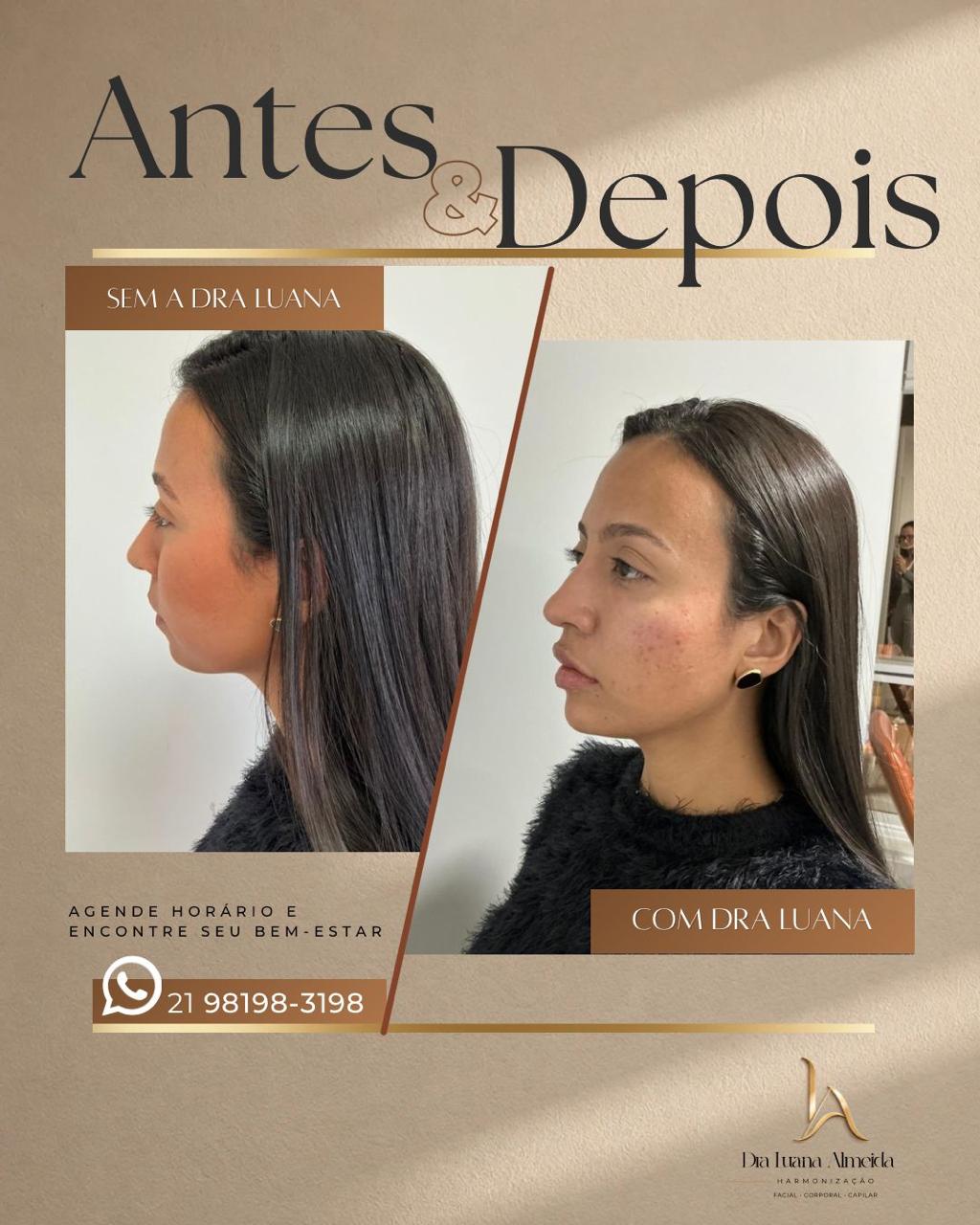 Viço e qualidade da pele — antes e depois